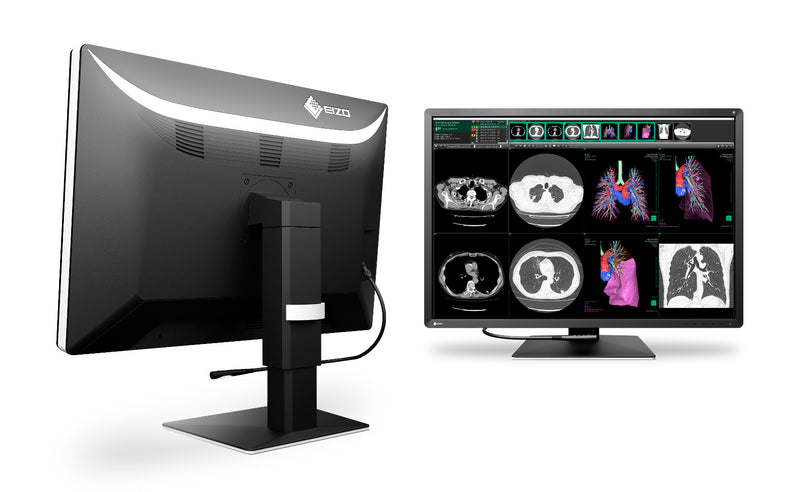 How to choose a medical imaging monitor